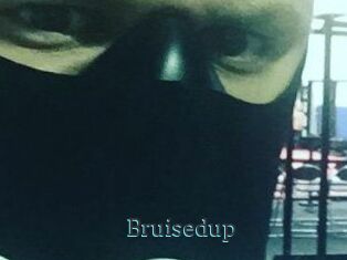 Bruisedup