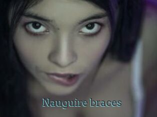 Nauguire_braces